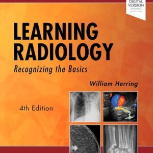 Learning Radiology: Recognizing the Basics Paperback – 3 May 2019