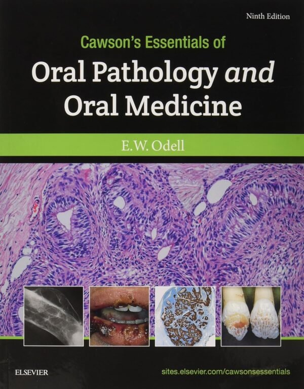 Cawson's Essentials of Oral Pathology and Oral Medicine Paperback – 14 July 2017