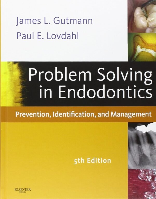 Problem Solving in Endodontics: Prevention, Identification and Management Hardcover – 20 August 2010